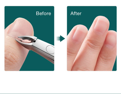 Stainless Steel Cuticle Nipper and Pusher Tool - Smarsty