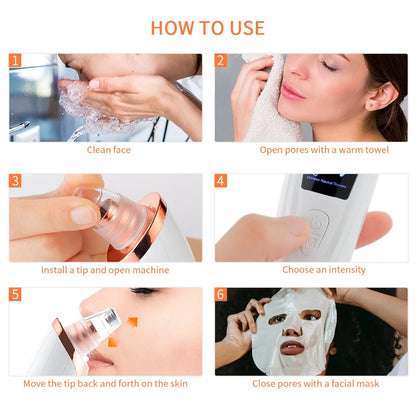 Vacuum Blackhead Remover With USB Charging Convenience - Smarsty