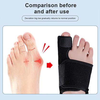 Toe Corrector Orthotics for Hallux Valgus Relief - Smarsty