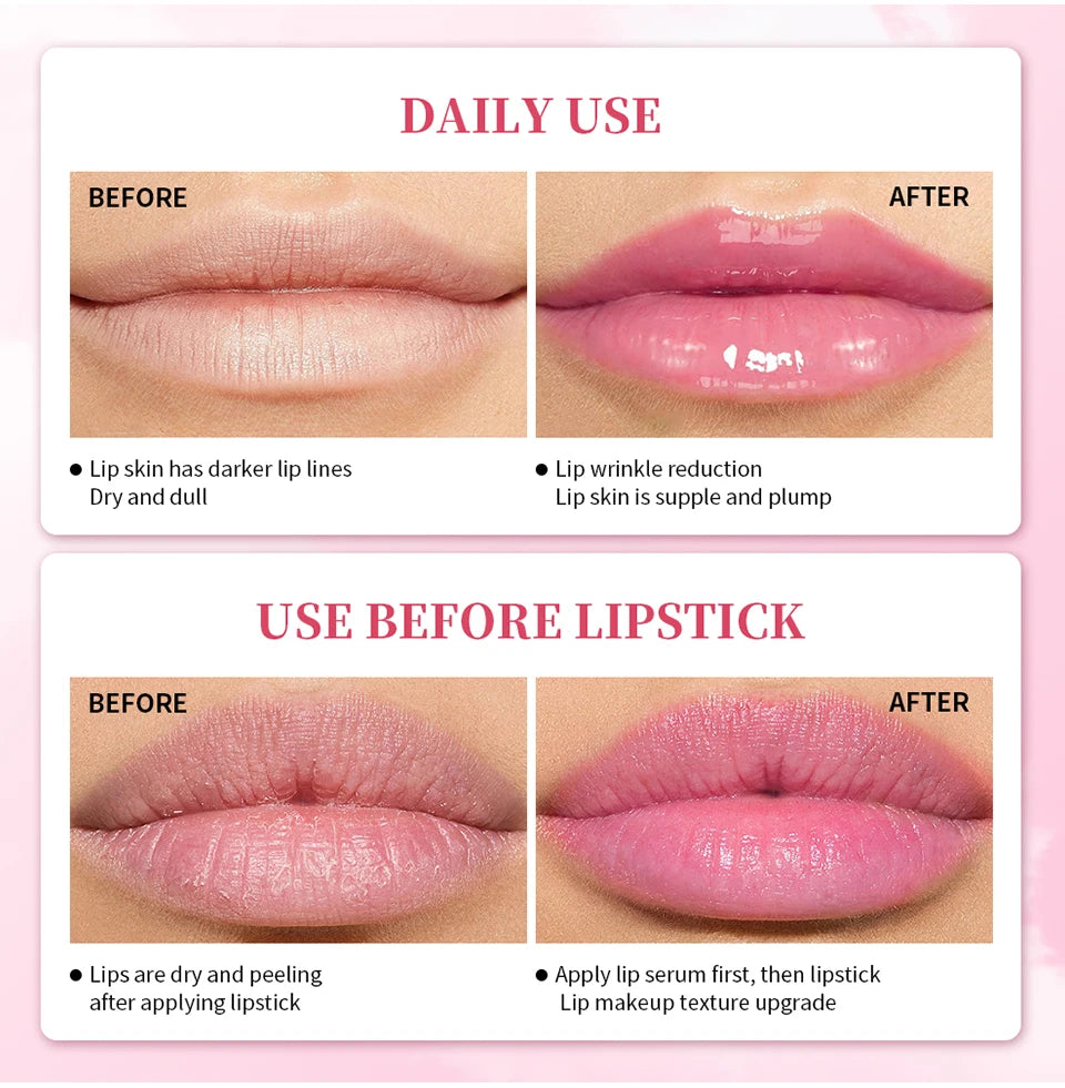 Pink Lip Serum Lotion for Moisturized and Smooth Lips - Smarsty