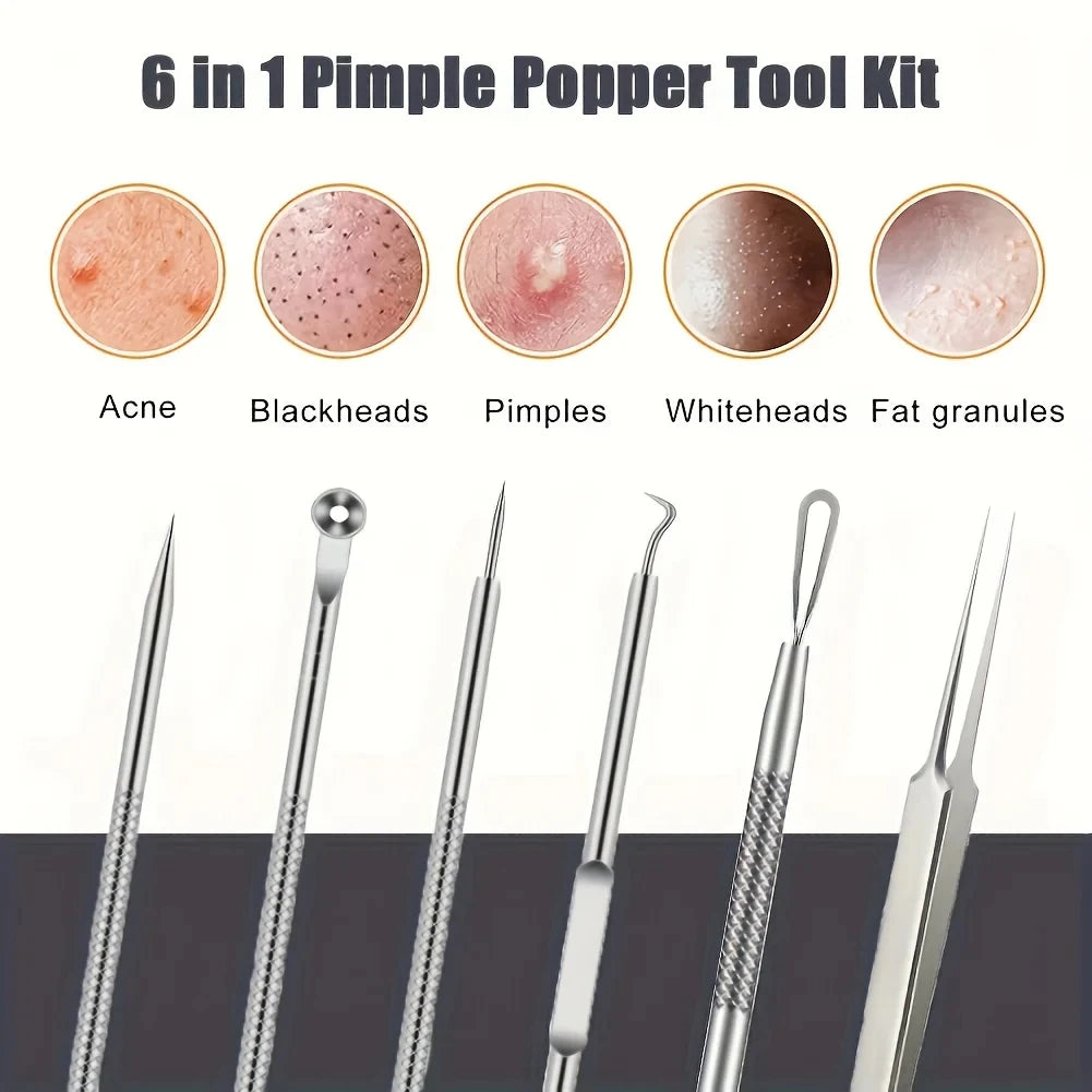 6 Piece Pimple Popper Tool Kit for Effective Acne Removal - Smarsty