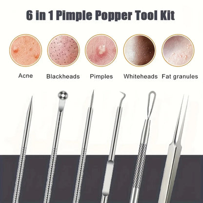 6 Piece Pimple Popper Tool Kit for Effective Acne Removal - Smarsty