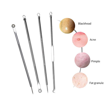 4PCS Acne Remover Tool Set for Clear Skin - Smarsty