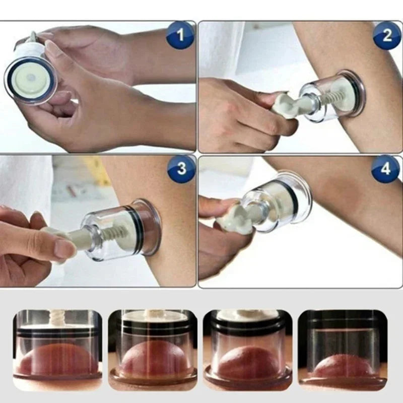 Vacuum Suction Cupping Cups for Nipple Enhancement - Smarsty