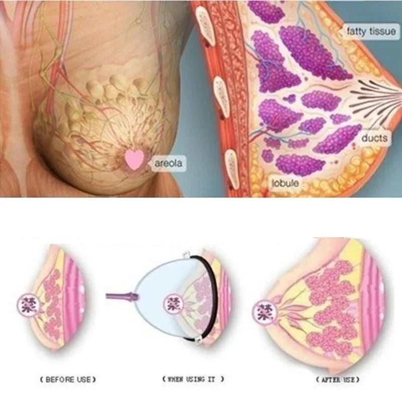 Vacuum Suction Cupping Cups for Nipple Enhancement - Smarsty