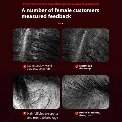 Electric Microcurrent Massage Comb for Hair Growth - Smarsty
