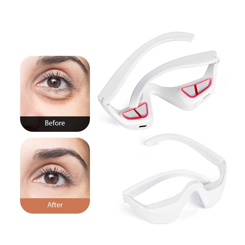 3D Eye Massager for Fatigue Relief and Dark Circles - Smarsty